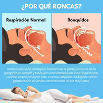 Protector Dental Para Bruxismo y Ronquidos